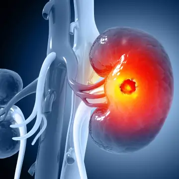Donate with us - living kidney donation
