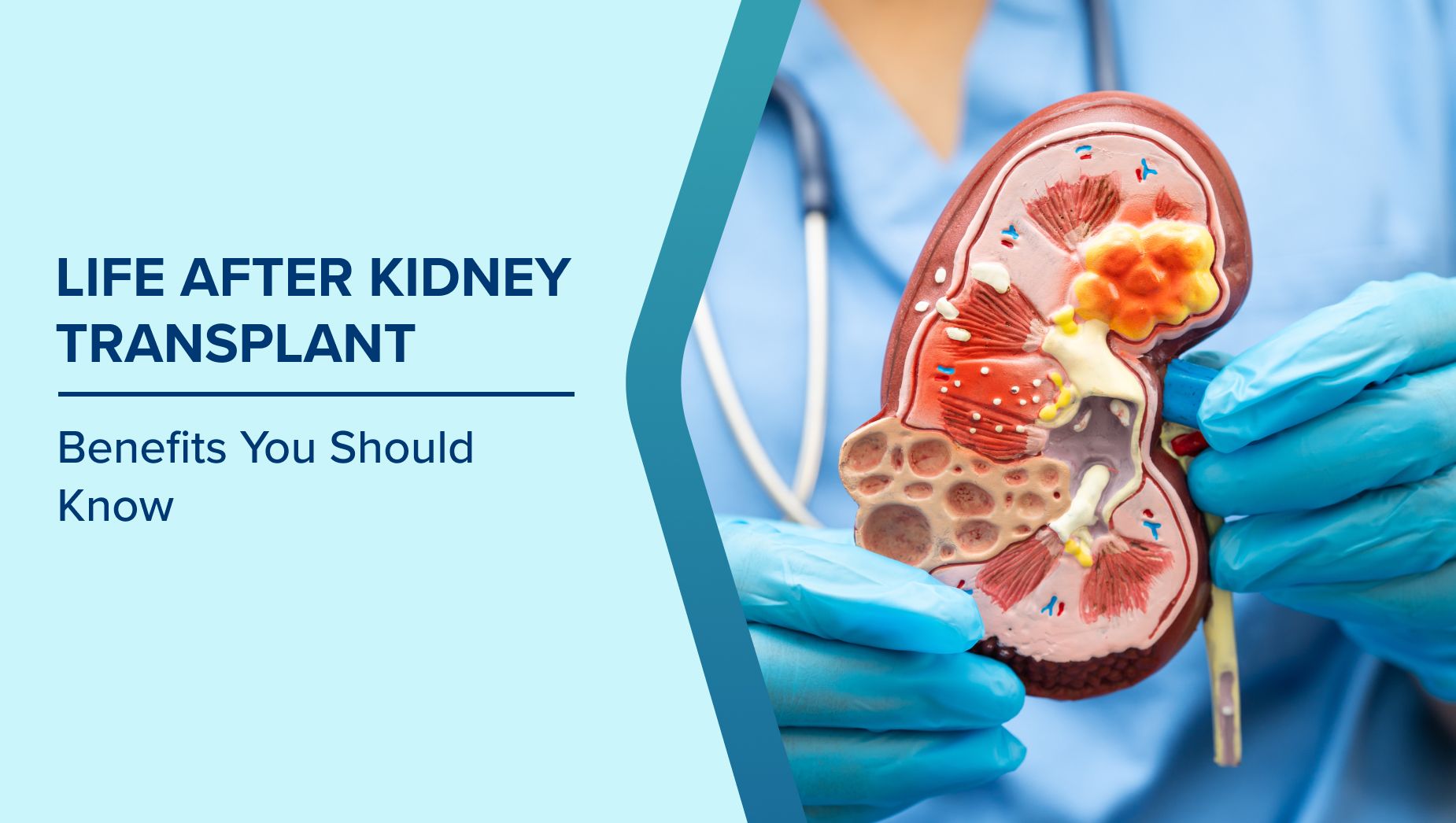 Living kidney donation information